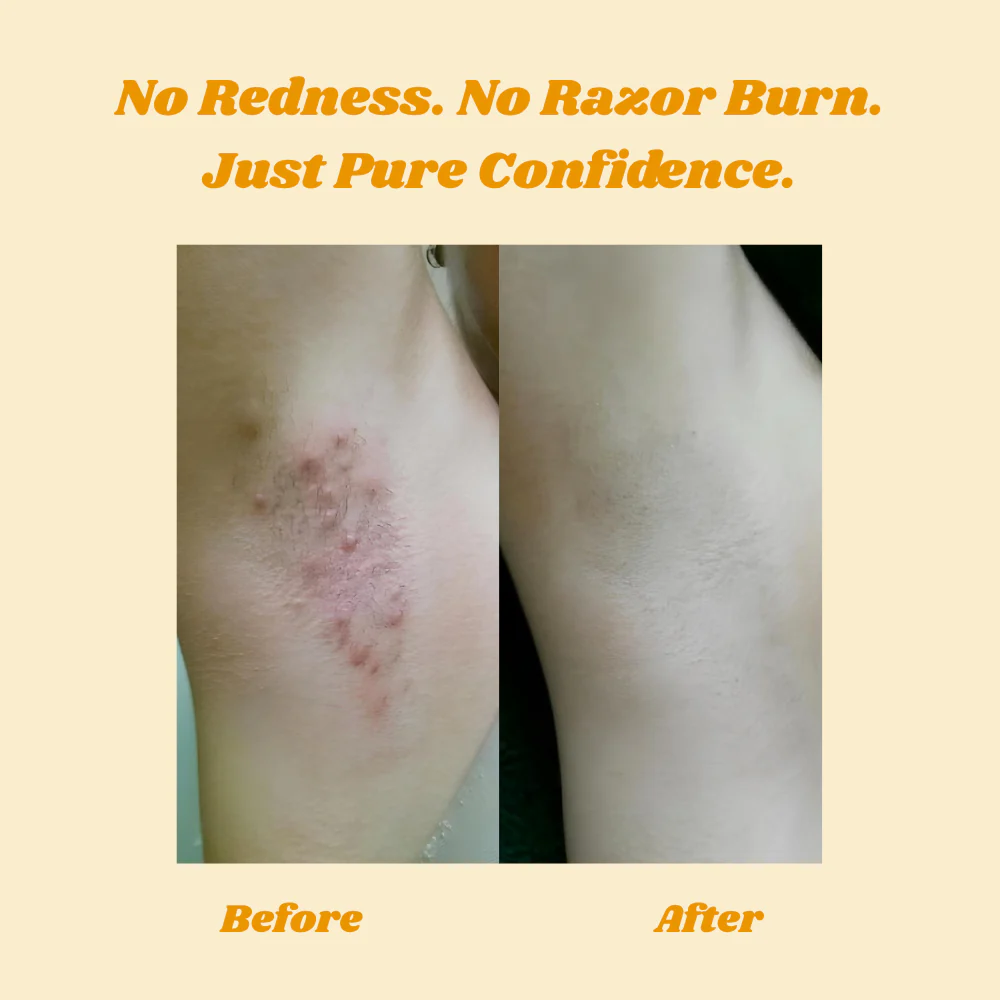 HoneyMousse™ — Experience Pain-Free, Irresistibly Smooth Skin That Lasts Weeks - Image 5