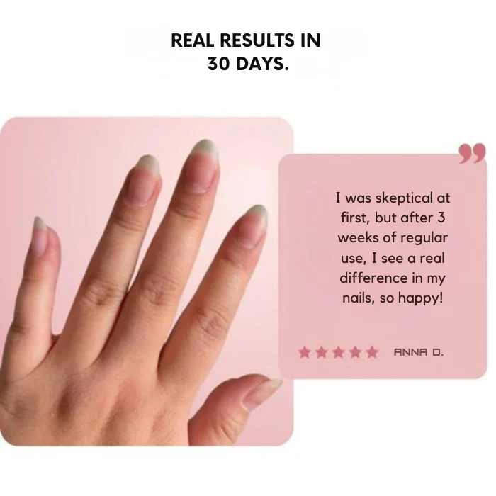 VelaNail™ — Transform Your Nails into Strong, Radiant Confidence Boosters - Image 4