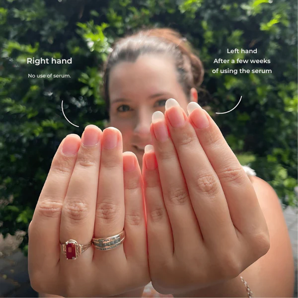 VelaNail™ — Transform Your Nails into Strong, Radiant Confidence Boosters - Image 7