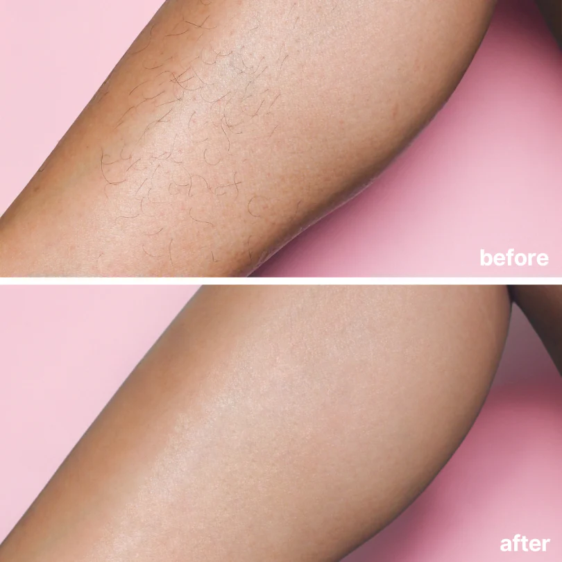 Bare Basics No Shave Hair Removal Cream - Sale - Image 5