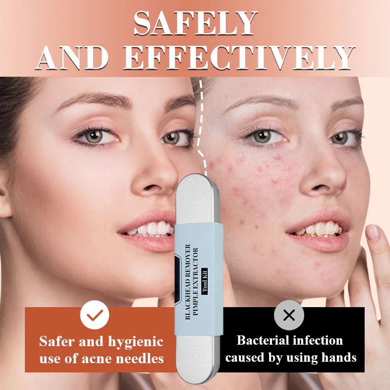Stainless steel blackhead removal kit - Image 2