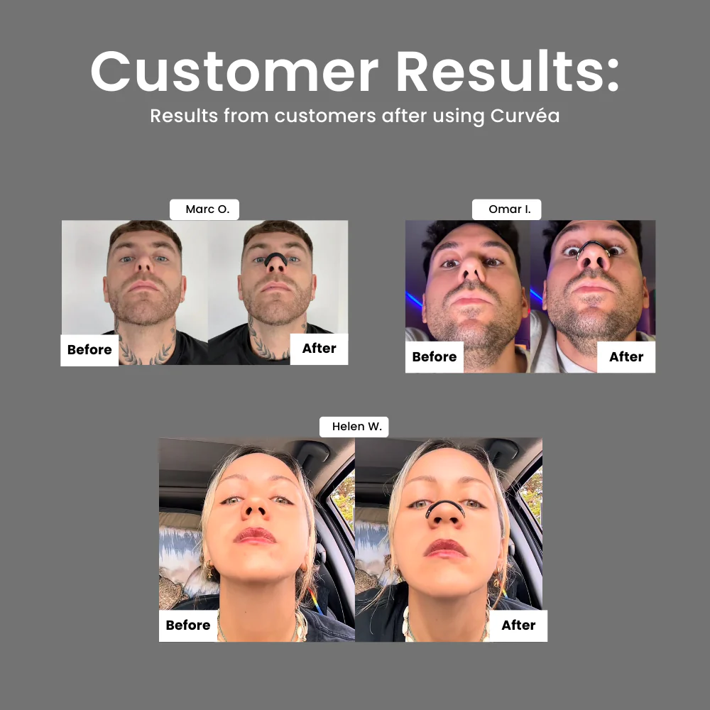 BreathAero™ Nose Strip - Image 3