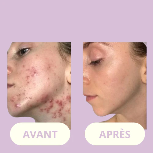 ClearSkin Wand™ - Image 4