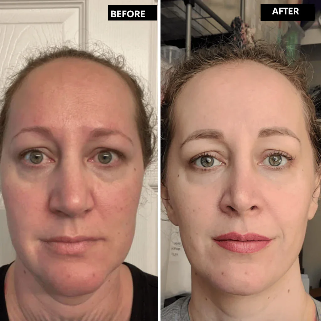 DermaVive™ — Unlock Firm, Radiant Skin That Turns Heads in Just 14 Days - Image 9