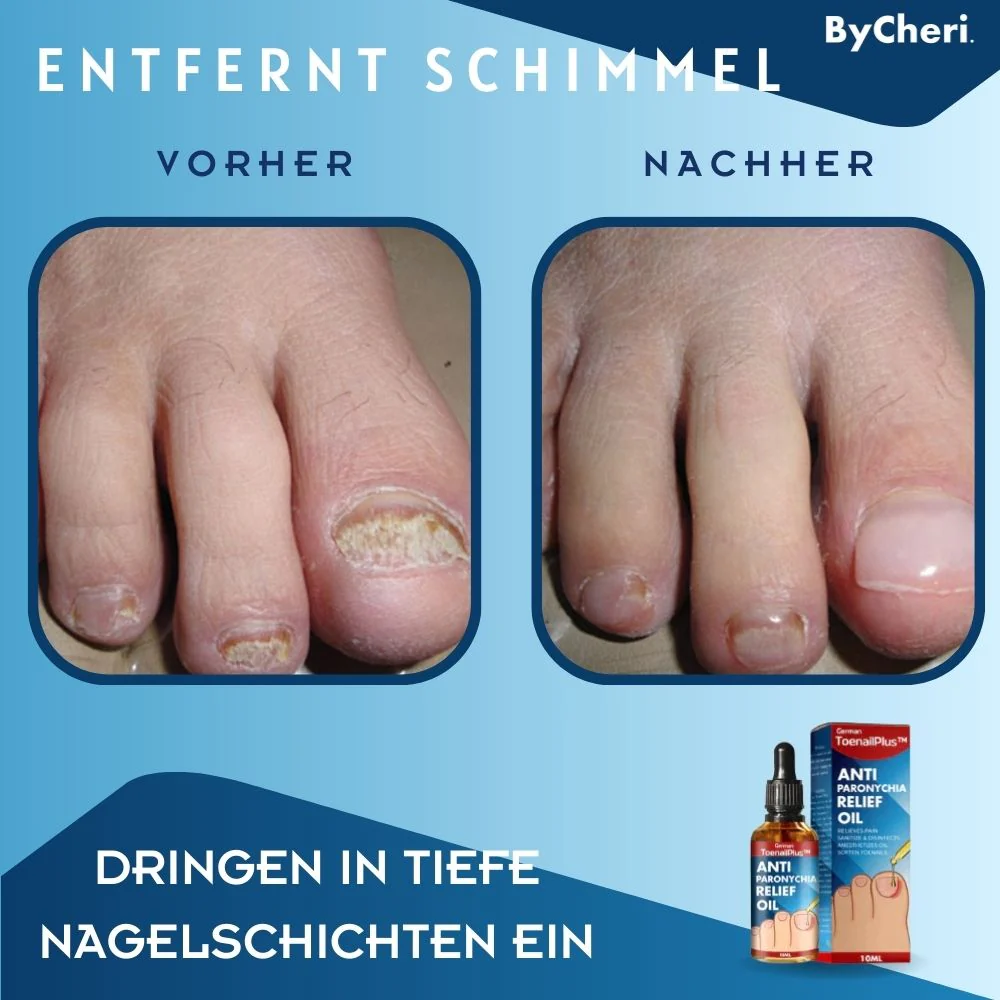DermGuard™ — Walk Proud with Pain-Free, Beautiful Nails Fast - Image 2