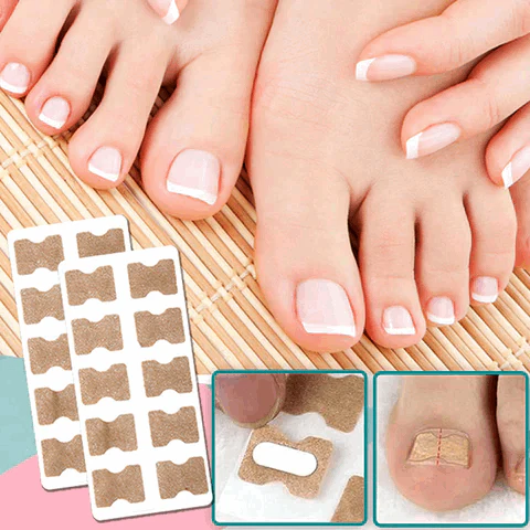 FinePatches™ | Correction Patches for Beautiful and Healthy Nails - Image 3