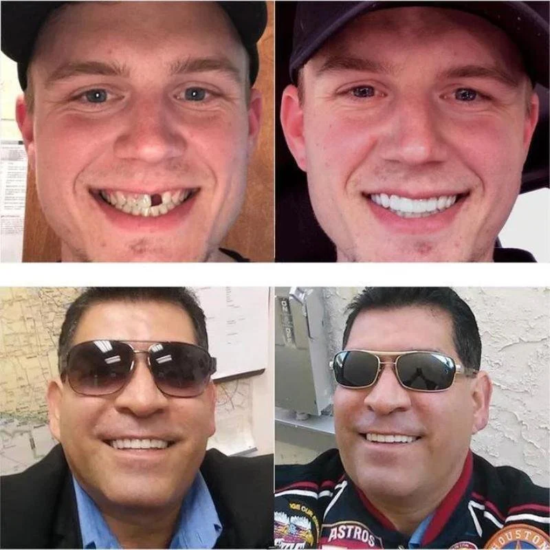 FlairFit™ Smile Shapers — Instantly Own a Confident, Flawless Smile Without the Dentist - Image 6