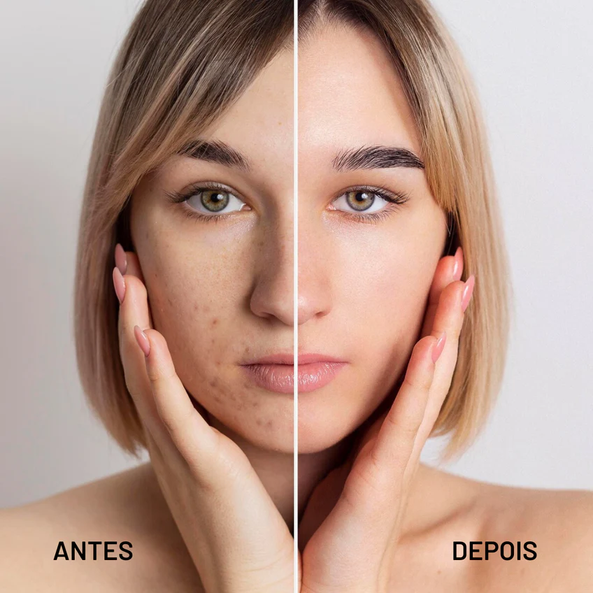GlowEssence™ — Unlock Your Skin’s Perfect Glow and Ageless Confidence - Image 2