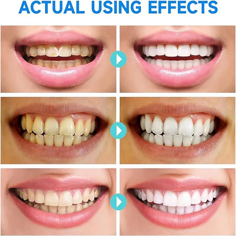 GlowMint™ — Transform Your Smile with Soothing, Stain-Fighting Power Every Day - Image 4