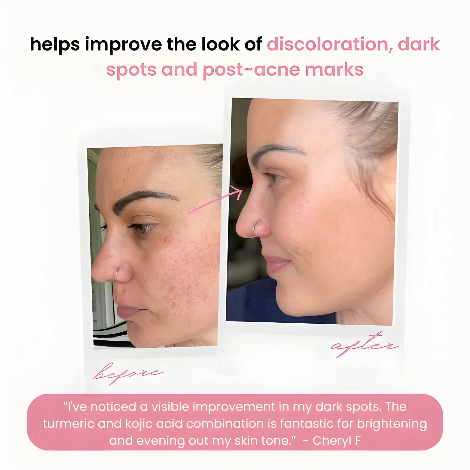 GlowNexa™ — Unleash Your Radiant, Spot-Free Glow Instantly - Image 5