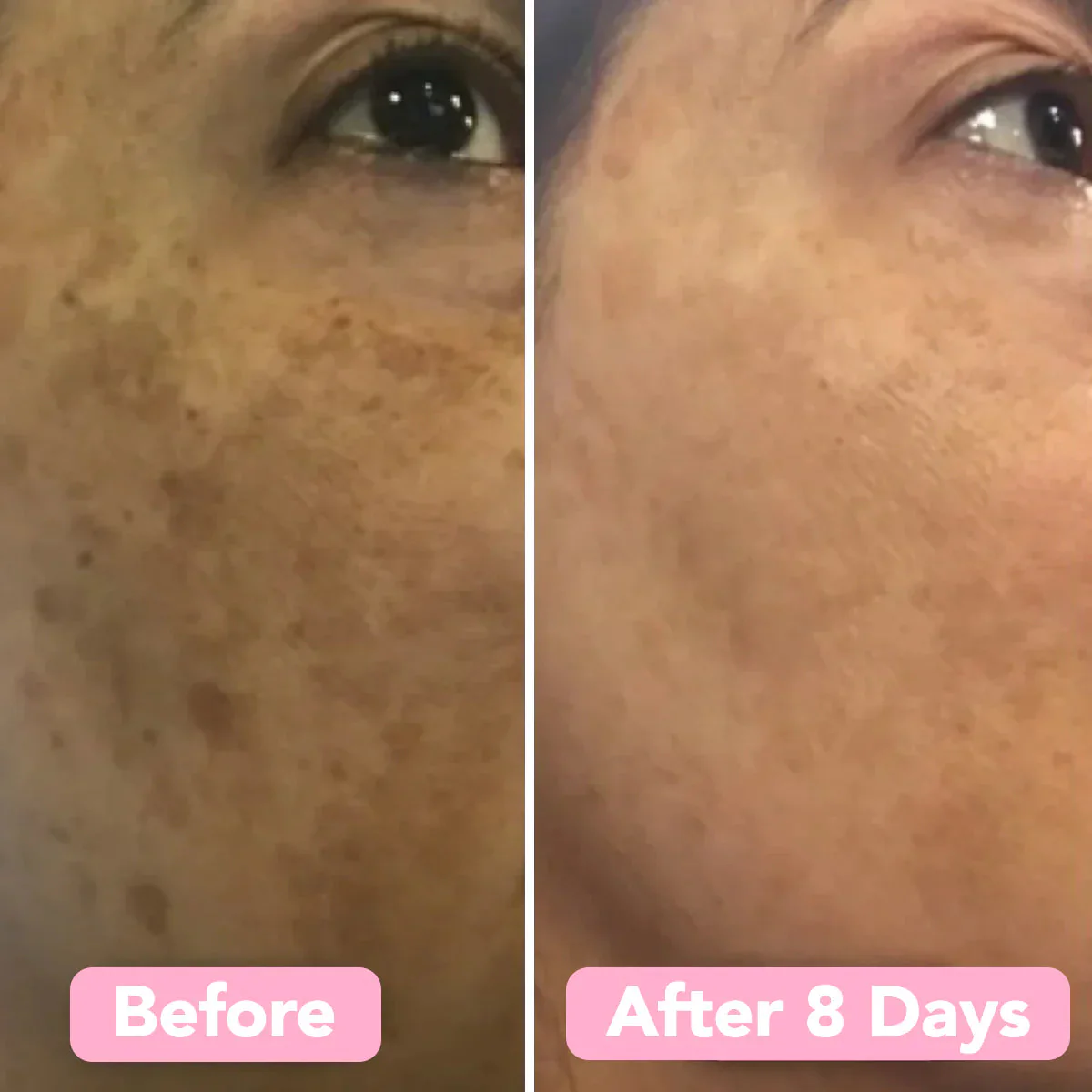GlowNexa™ — Unleash Your Radiant, Spot-Free Glow Instantly - Image 8