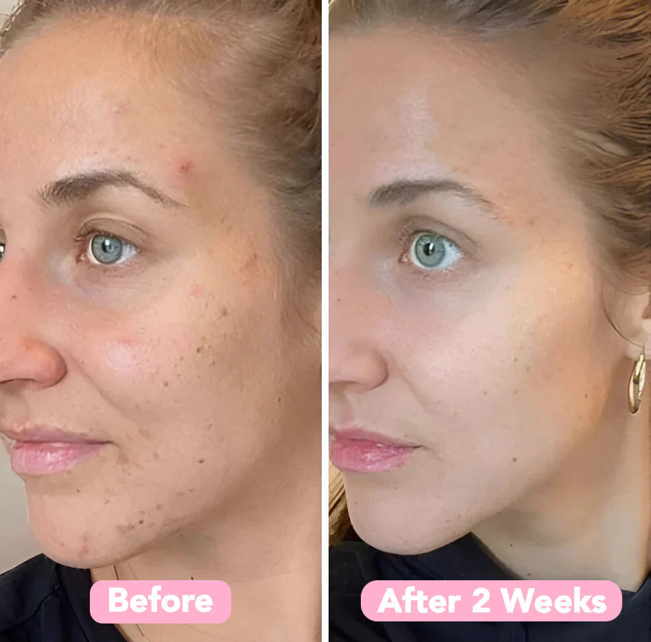 GlowSurge™ Elixir Pads — Transform Dull Skin into Radiant, Youthful Glow Overnight - Image 7