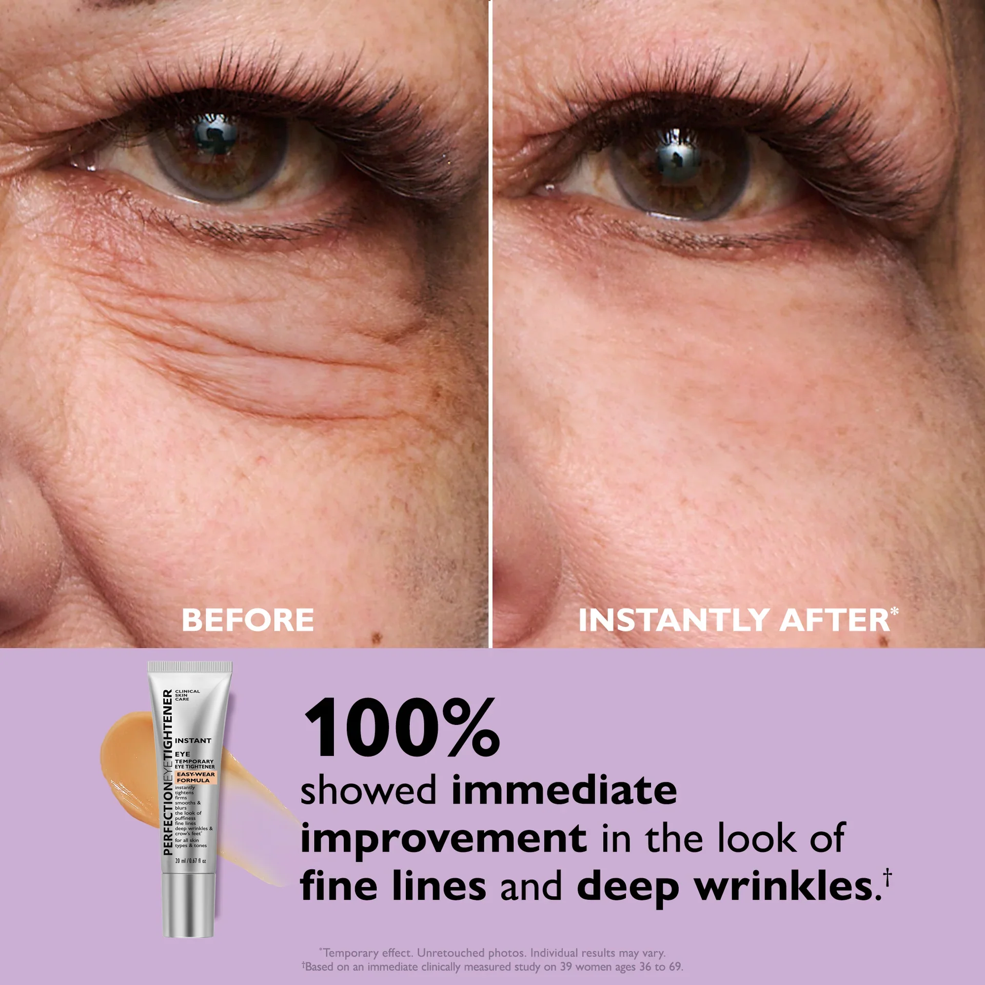 Liftiva™ — Instantly Revive Tired Eyes for a Youthful, Energized Look All Day - Image 2