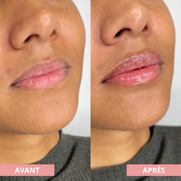 Arvilaro | Kit Ritual Lips - Thicker & Shiny lips in minutes - Image 10