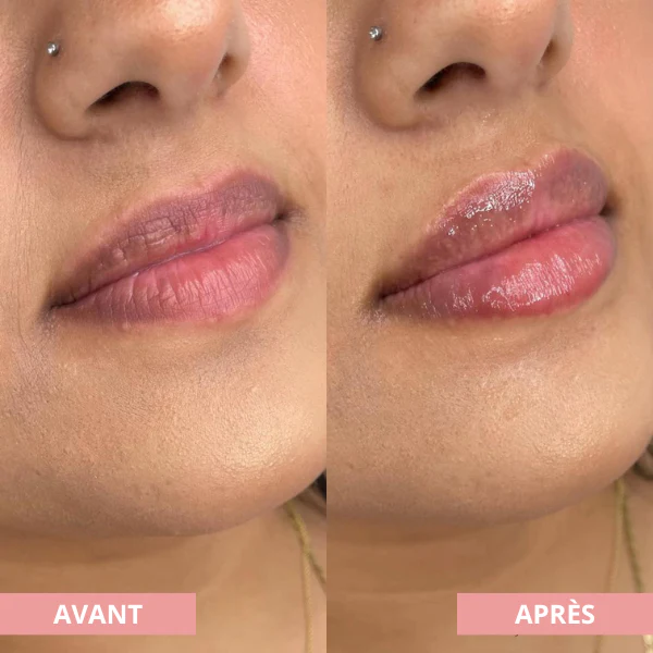 Arvilaro | Kit Ritual Lips - Thicker & Shiny lips in minutes - Image 3