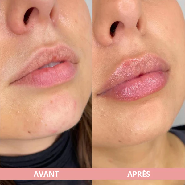 Arvilaro | Kit Ritual Lips - Thicker & Shiny lips in minutes - Image 4