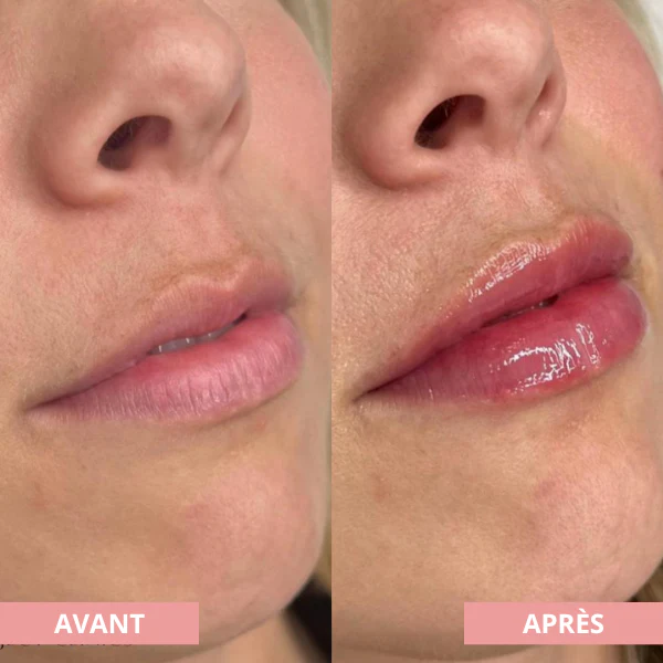 Arvilaro | Kit Ritual Lips - Thicker & Shiny lips in minutes - Image 7