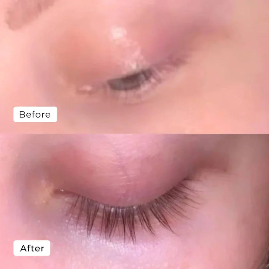 LashAura™ — Wake Up to Naturally Bold, Head-Turning Lashes in Just One Week - Image 5