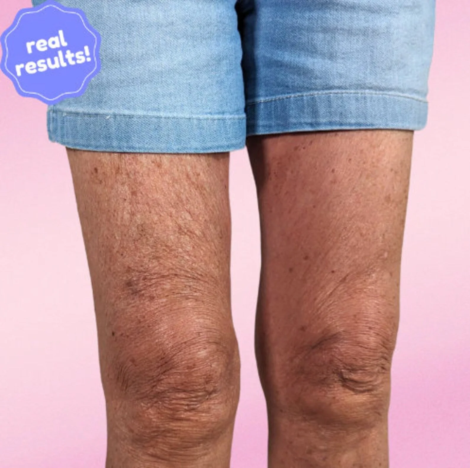 LiftAura™ — Instantly Tighten & Smooth Skin for All-Day Confidence - Image 7