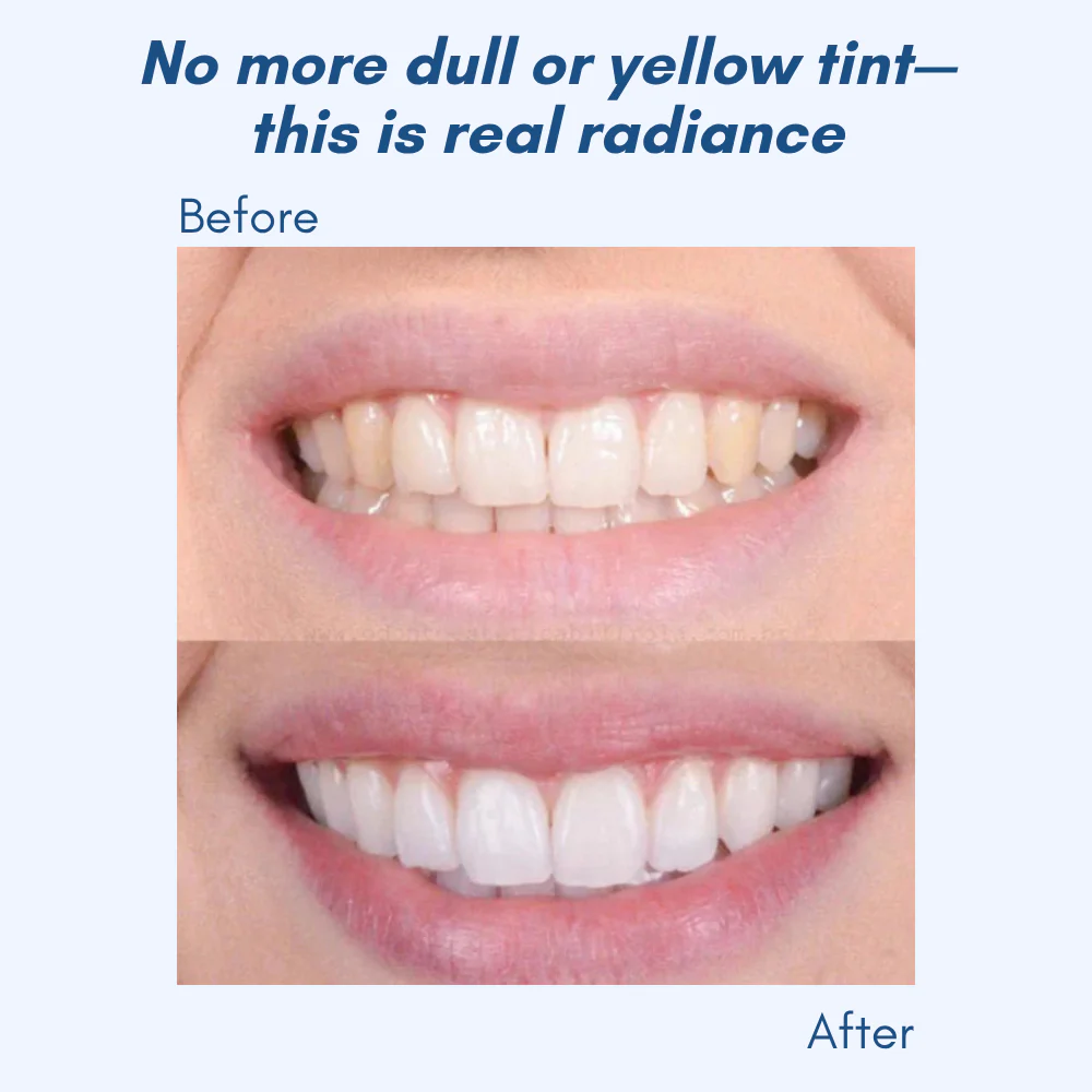 LumaShine™ — Glow Brighter Instantly with a Comfortable, Confidence-Boosting Smile - Image 4