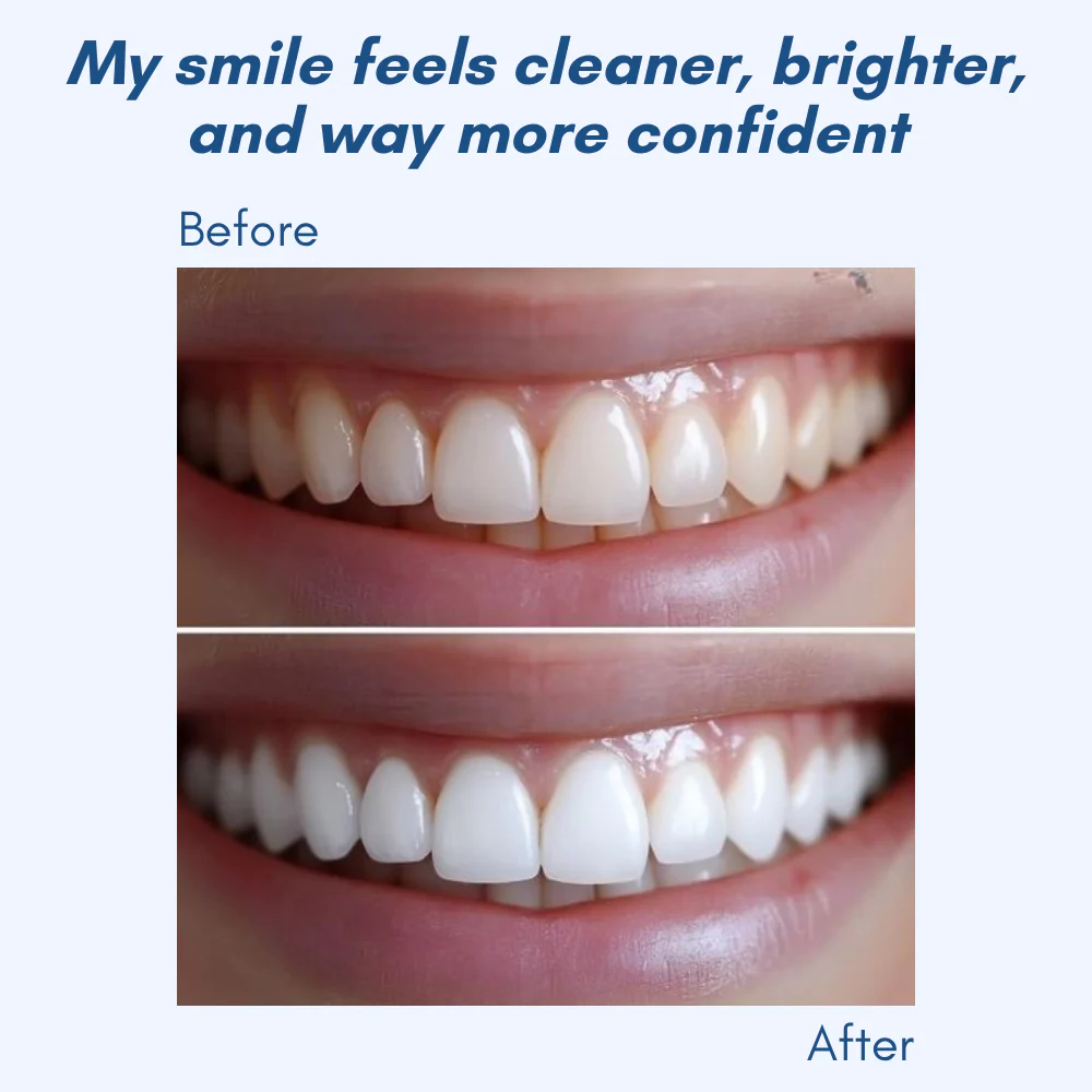 LumaShine™ — Glow Brighter Instantly with a Comfortable, Confidence-Boosting Smile - Image 5