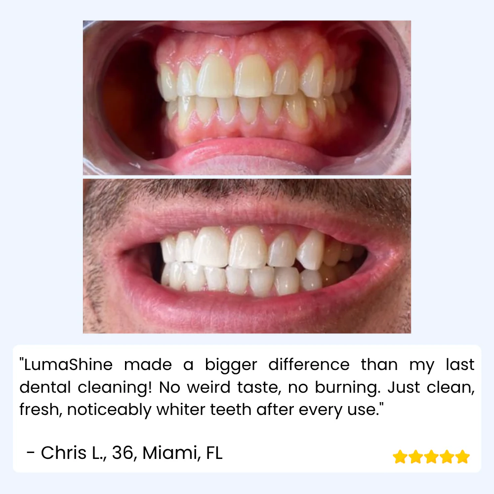 LumaShine™ — Glow Brighter Instantly with a Comfortable, Confidence-Boosting Smile - Image 6