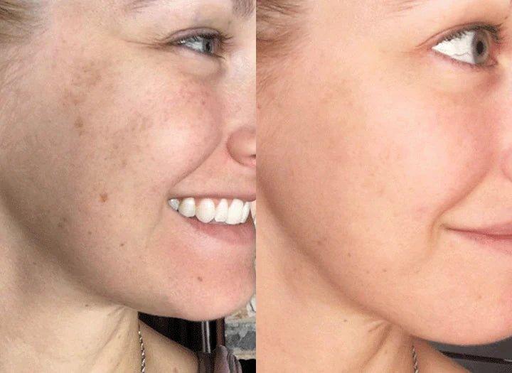 LumaTide⢠ā Unlock Radiant, Silky Skin That Commands Attention Instantly - Image 3
