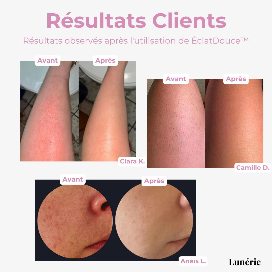 LumiAura™ — Unlock Silky, Radiant Skin That Feels Like Pure Confidence - Image 3