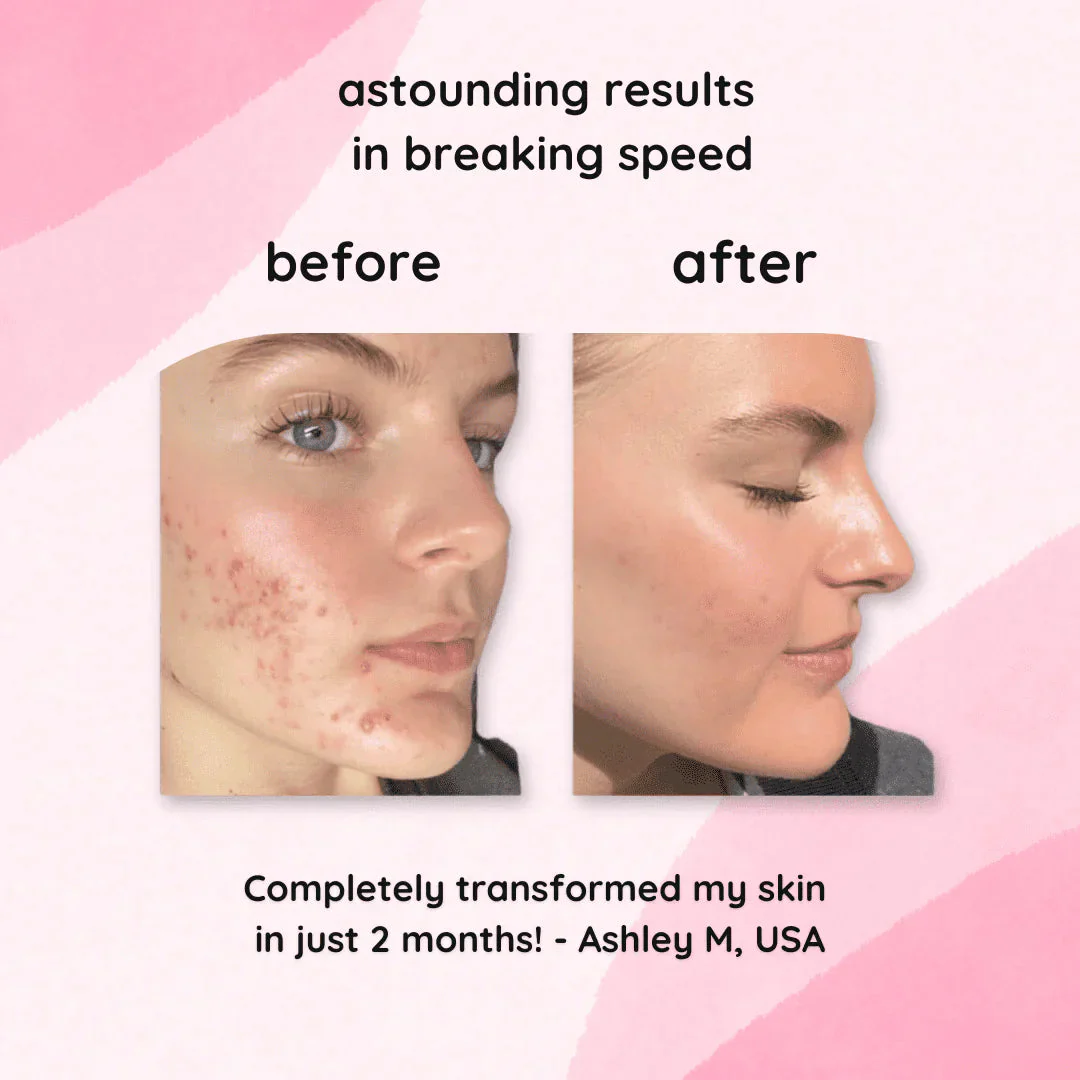 LumiDerm™ — Transform Your Skin with a Radiant, Spot-Free Glow in Just Weeks - Image 6