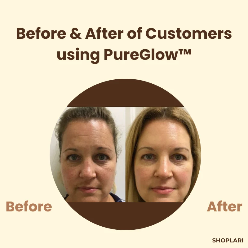 LumiNest™ Black Tea Mask — Reveal Radiant, Flawless Skin That Commands Attention - Image 5