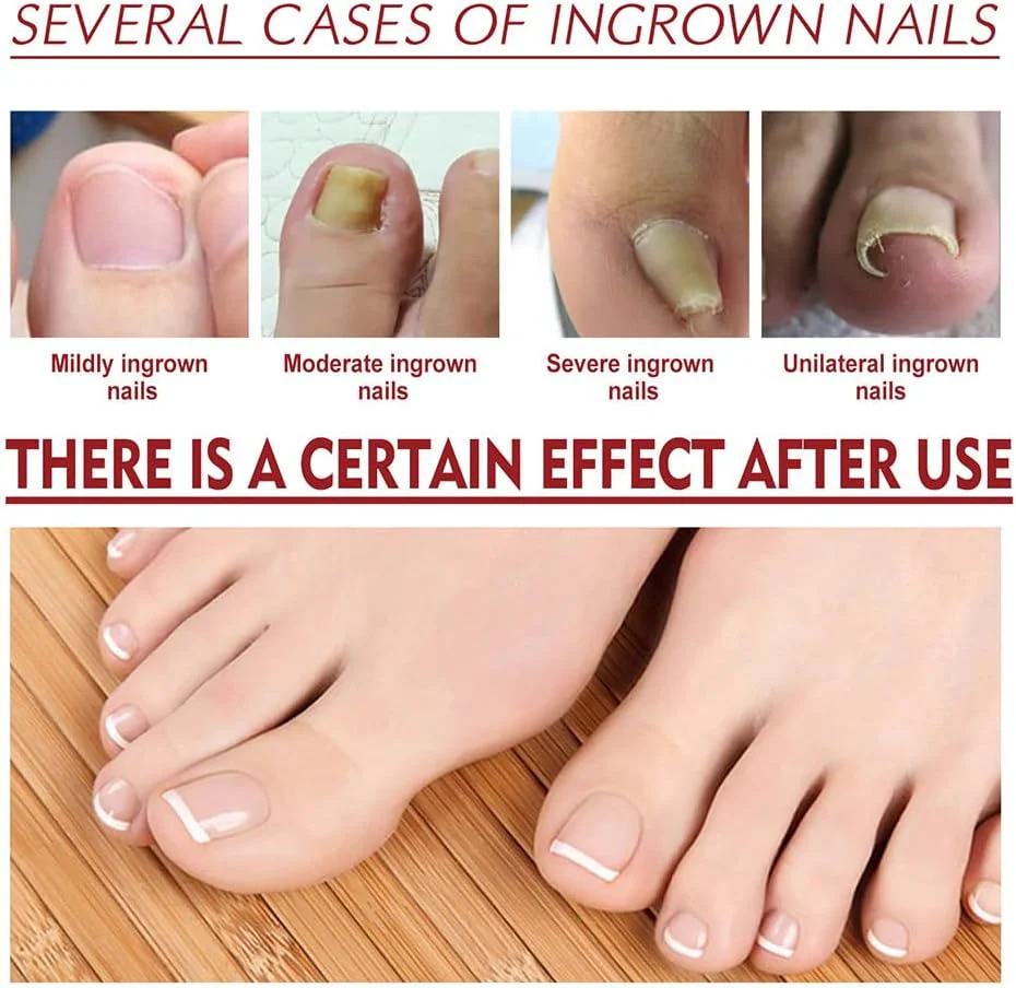 NailCure™ — Unleash Stunningly Strong Nails That Command Attention in Just Weeks - Image 3