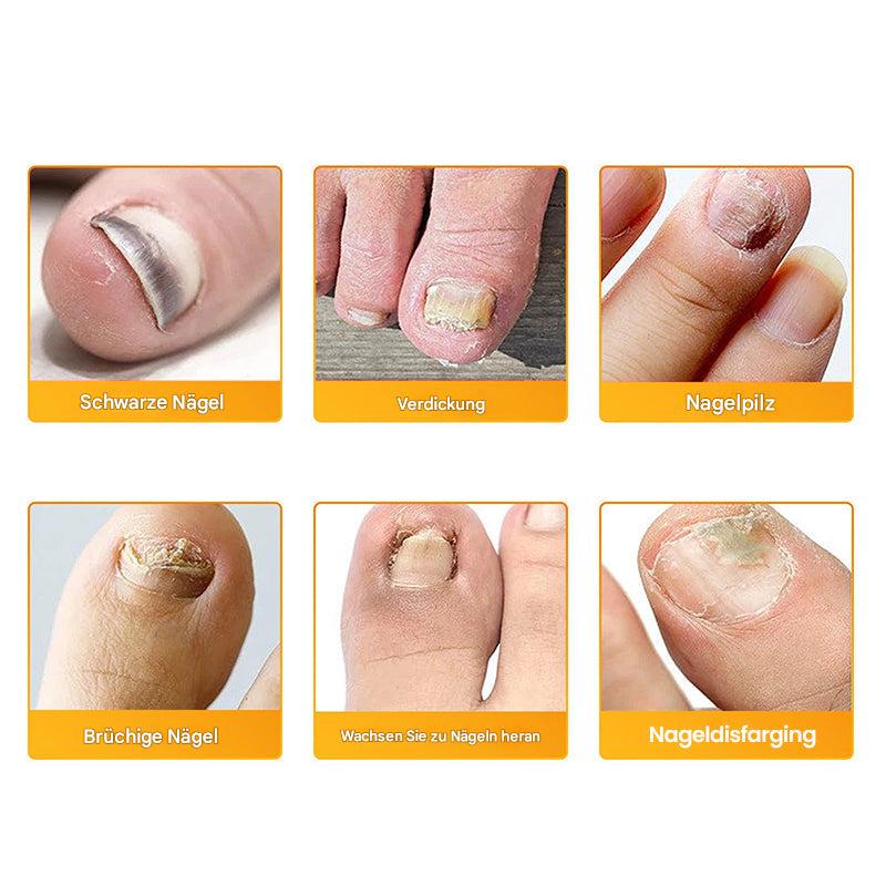 NailVive™ — Reveal Gorgeous Nails That Boost Your Confidence Every Day - Image 5