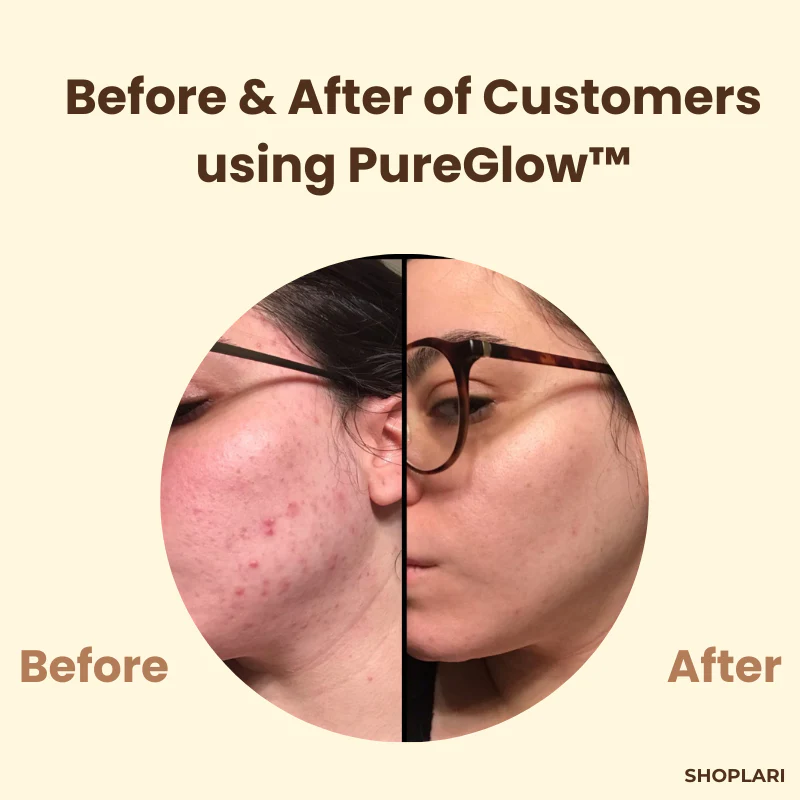 RamaraRadiance™ — Unleash Clear, Confident Skin That Glows With Youthful Radiance - Image 3