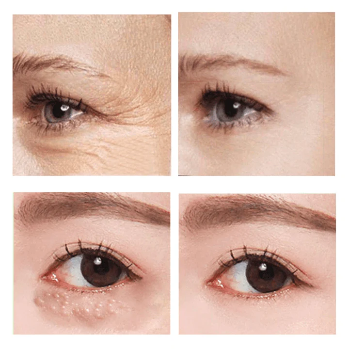 RaminaLift™ — Instantly Brighten and Revitalize Your Eyes for a Youthful, Energized Look - Image 2
