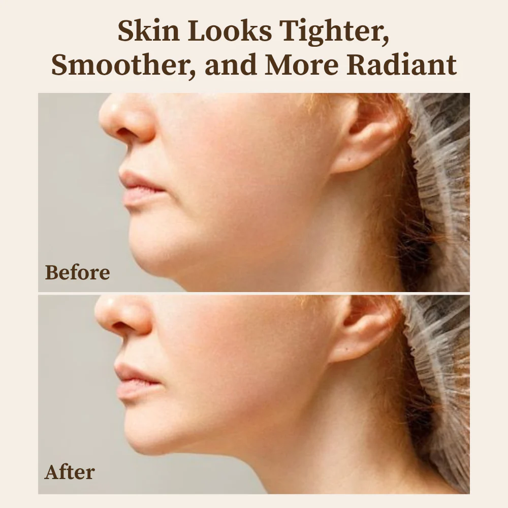 RamoraLift™ — Reveal Youthful, Radiant Skin That Defies Time Instantly - Image 4
