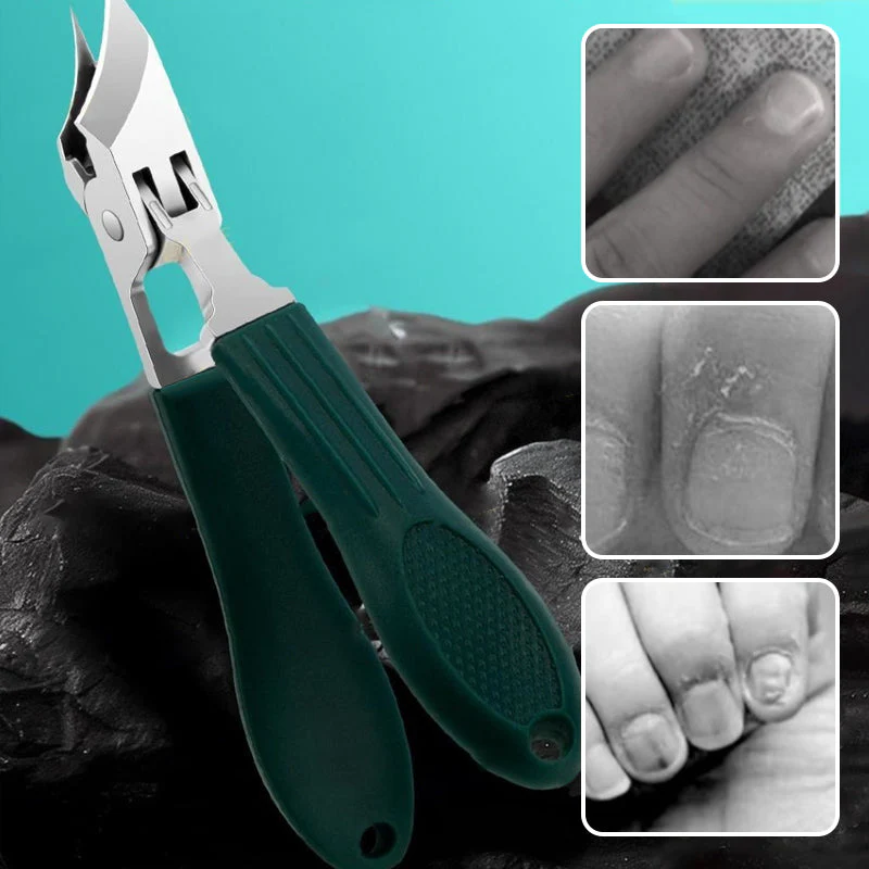 RazorSharp™ Nail Trimming Set — Experience Perfectly Clean Nails Without the Mess or Hassle - Image 2