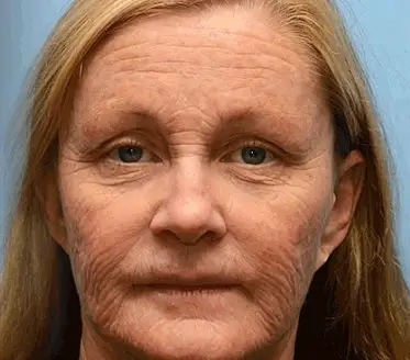 ReviRadiance™ — Unlock Youthful Lift and Radiance Without Needles or Waiting - Image 2