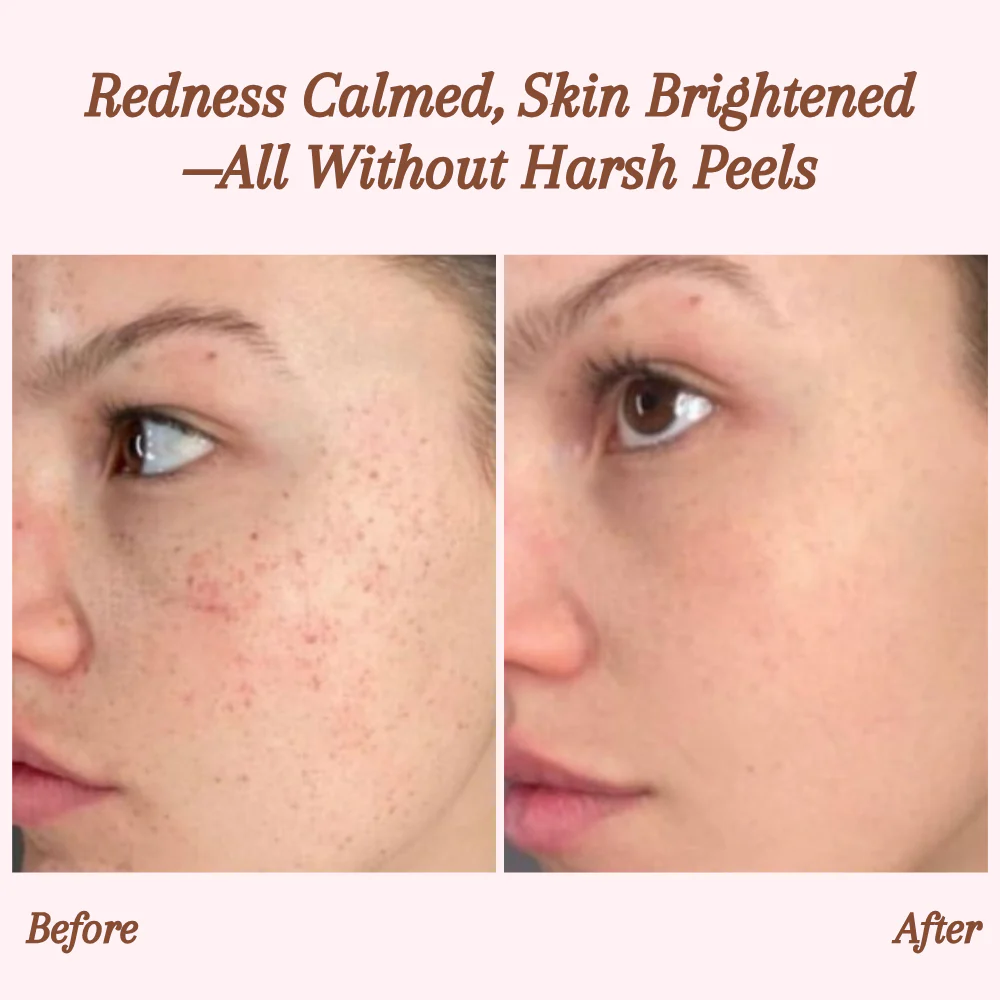 RevitaDerm™ — Unleash Radiant, Silky Skin and Banish Flaws for Good - Image 5