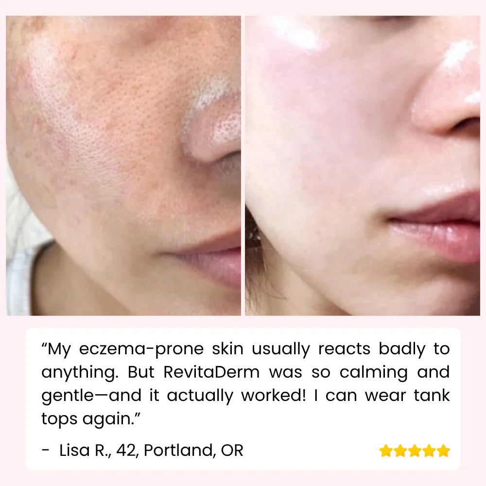 RevitaDerm™ — Unleash Radiant, Silky Skin and Banish Flaws for Good - Image 8