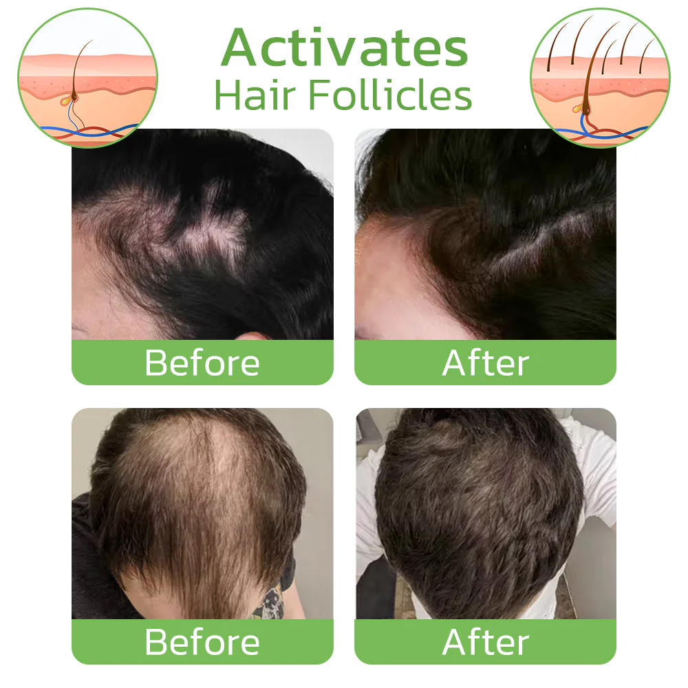 RevitaNest™ Hair Renewal Spray — Wake Up to Thicker, Stronger Hair Every Morning - Image 5