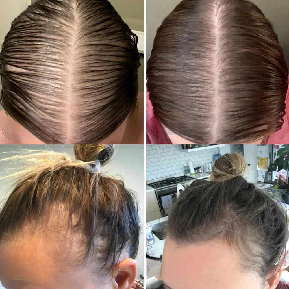 RevitaTress™ — Ignite Your Hair’s Power with Thick, Lush Growth in 45 Days - Image 5