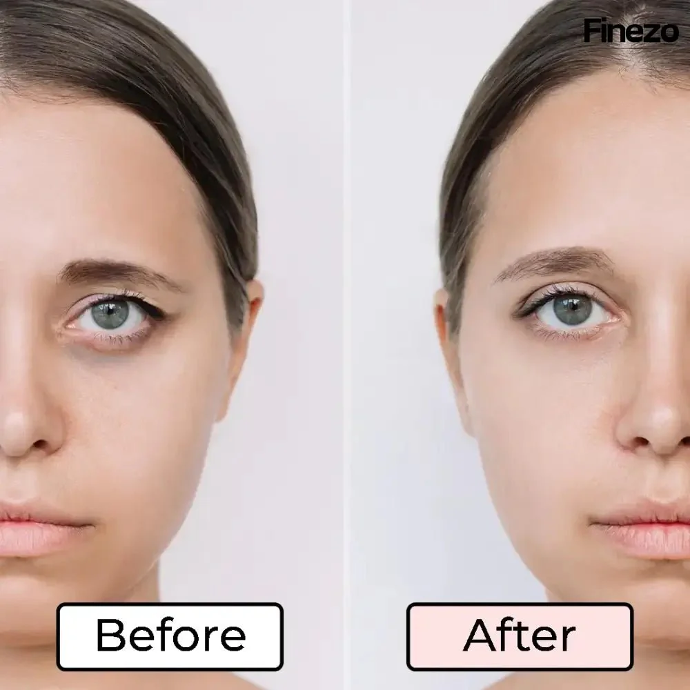 RevitaVue™ — Instantly Revive Tired Eyes and Reveal Youthful Radiance - Image 6