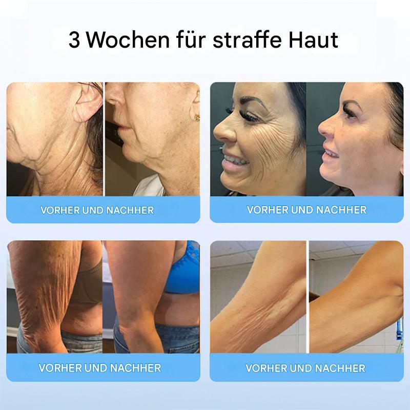 SeraphaLift™ — Instantly Firm, Smooth, and Reclaim Youthful Confidence - Image 3