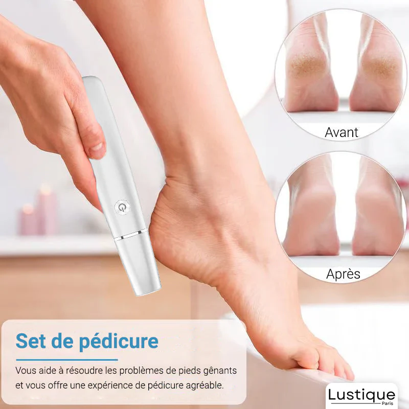 SilkStep™ Electric Callus Remover — Effortless Soft Feet You’ll Love Showing Off - Image 2