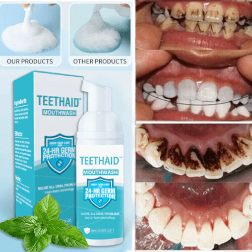 Teethaid⢠Pure Herbal Teeth Whitening & Mouth Repair Mousse - Image 5