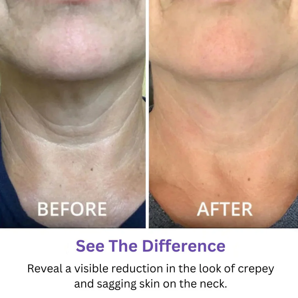 Tighten & Lift Neck Cream | Arvilaro | 1+1 FREE - Image 2