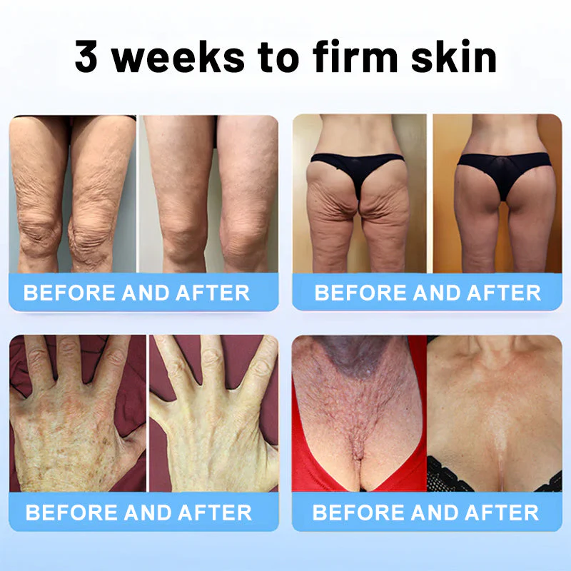VelaRise™ Tightening Stick — Instantly Lift and Renew Your Youthful Glow Without Pain or Mess - Image 5