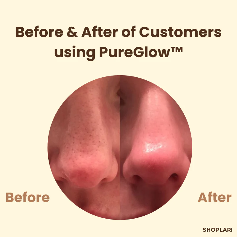 VeluxeTea™ — Unleash Radiant, Youthful Skin That Commands Admiration - Image 4