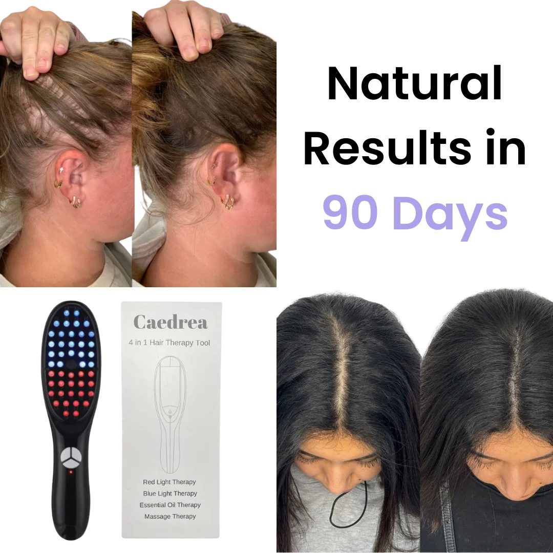 VelvetRoot™ — Restore Radiant, Head-Turning Hair Confidence in Just 30 Days - Image 14