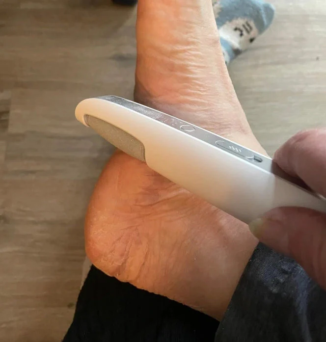 VelvetWalk™ Smoother — Effortlessly Reveal Baby-Soft Feet That Boost Your Confidence - Image 16